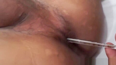 Ethnic doctor plays with twink patients ass