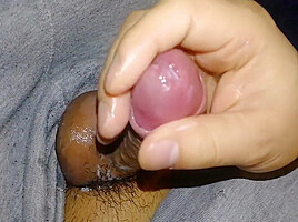 Uncut Micropenis Oozing Precum And Gets Jerked Until Thick Gooey Cum Splurts! Sorry For Shaky Cam!